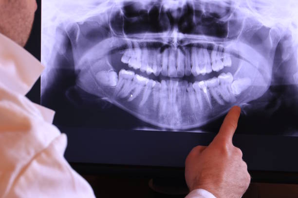Best Emergency Tooth Extraction in Wadley, GA